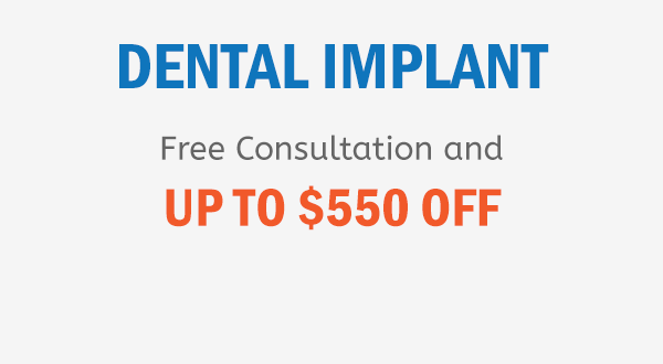 offers | dental implant